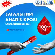 Загальний аналіз крові за 100грн!