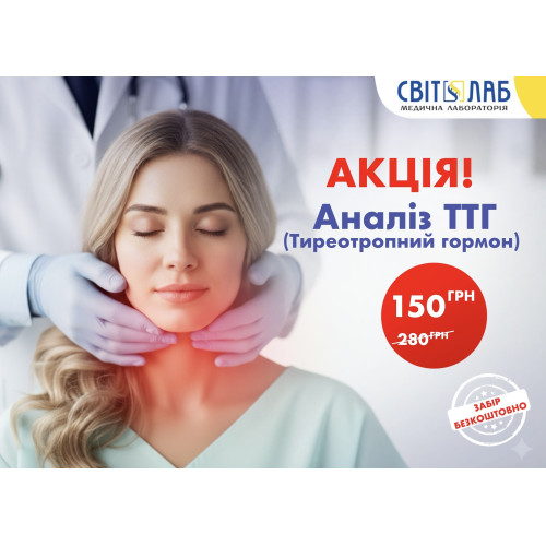 ТТГ (тиреотропний гормон) за 150 грн